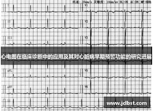 心电图在临床诊断中的应用及其对心脏病早期预警功能的研究进展